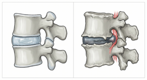 Back pain prevention through daily habits — Becker Chiropractic & Acupuncture in West Omaha